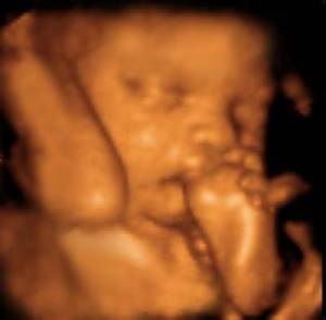 3d Ultrasound Baby